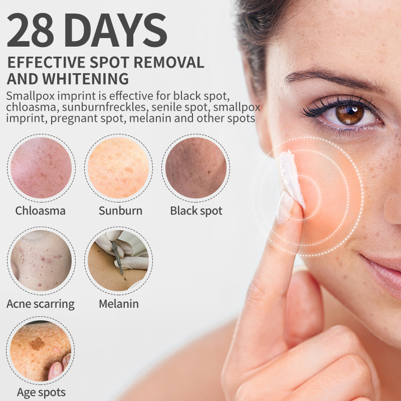 Dimollaure krem wybielający pi – Retinol Cream recenzja i cena