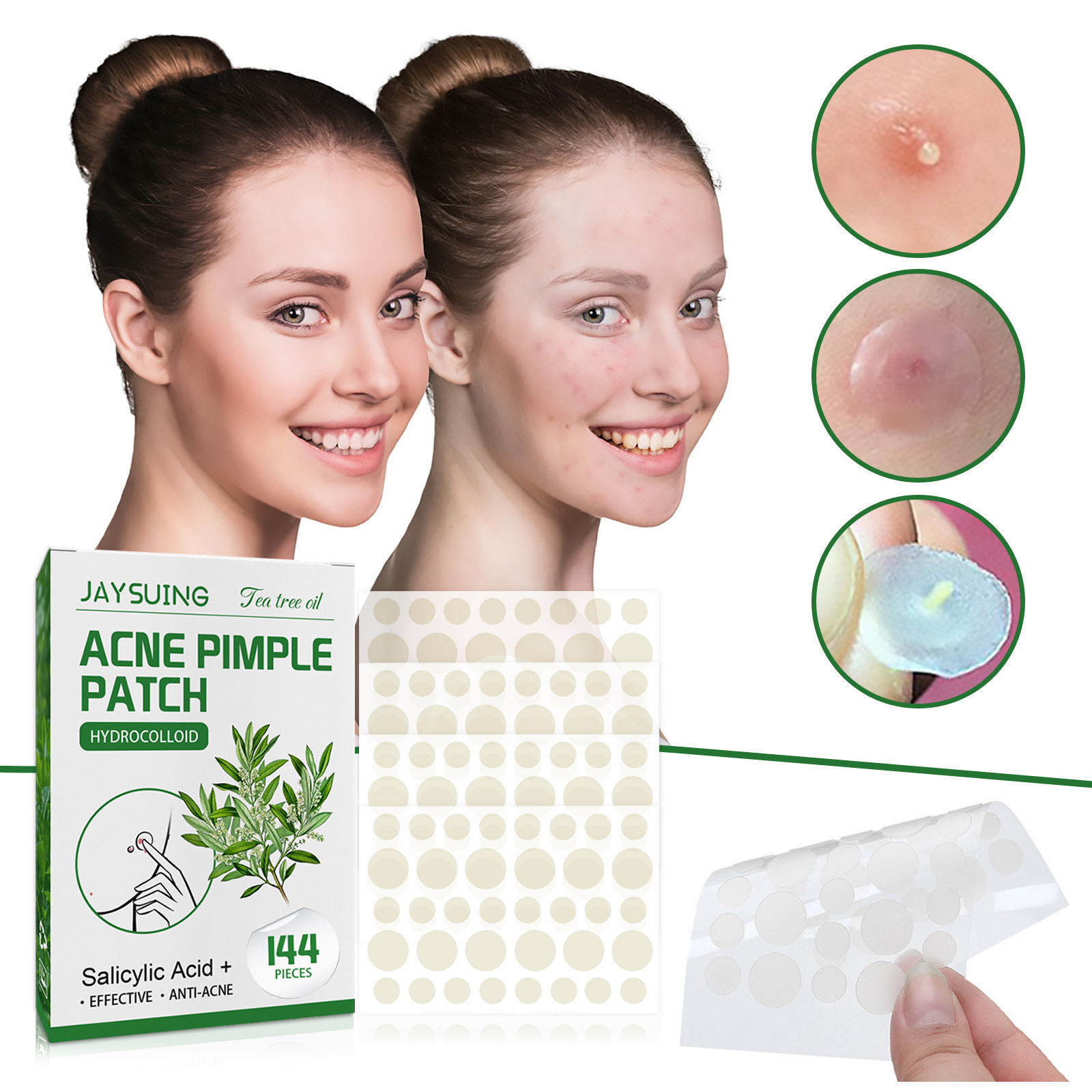 Plastry hydrokoloidowe na trąd – Face Oil recenzja i cena
